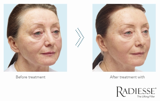 RAD B&A Image Full Facial and Improvement Skin Quality