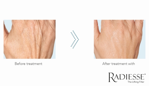 RAD B&A Image Hands