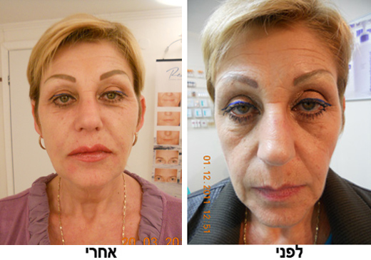 ד"ר אירנה סנדלר- מרפאה לאסתטיקה