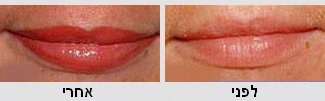איפור קבוע שפתיים