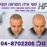 הראש לא נשאר קירח